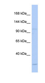 NAA15 / NARG1 antibody LS-C111212 Western blot of Fetal Kidney lysate.