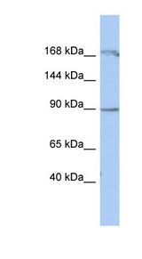 NAA15 / NARG1 antibody LS-C111213 Western blot of THP-1 cell lysate.