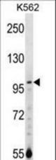 NARG1 Antibody western blot of K562 cell line lysates (35 ug/lane). The NARG1 antibody detected the NARG1 protein (arrow).