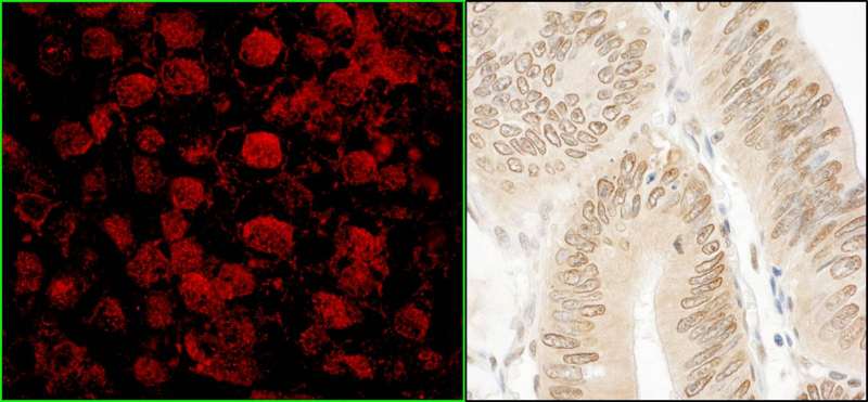 Detection of Human NARG1 by Immunofluorescence and Immunohistochemistry. Sample: FFPE sections of human testicular seminoma (left) and colon carcinoma (right). Antibody: Affinity purified rabbit anti-NARG1 used at a dilution of 1:80 (2.5 ug/ml) and 1:200 (1 ug/ml). Detection: Red-fluorescent Goat anti-Rabbit IgG-heavy and light chain, cross-adsorbed Antibody DyLight 594 Conjugated used at a dilution of 1:100 and DAB.