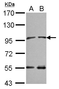 Sample (30 ug of whole cell lysate) A: NT2D1 B: IMR32 7.5% SDS PAGE NAA15 / NARG1 antibody diluted at 1:10000