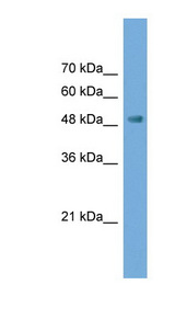 NPTX2 antibody LS-C135379 Western blot of Transfected 293T cell lysate.