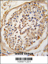 Formalin-fixed and paraffin-embedded human testis tissue reacted with NARP(Nptx2) Antibody (Center) LS-C98577, which was peroxidase-conjugated to the secondary antibody, followed by DAB staining.