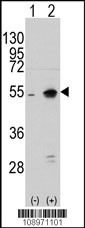 Western blot analysis of NARP(Nptx2) (arrow) using rabbit polyclonal NARP(Nptx2) Antibody (Center) LS-C98577.293 cell lysates (2 ug/lane) either nontransfected (Lane 1) or transiently transfected with the NARP(Nptx2) gene (Lane 2) (Origene Technologies).
