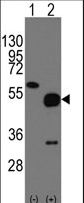 Western blot of NARP(Nptx2) (arrow) using rabbit polyclonal NARP(Nptx2) Antibody. 293 cell lysates (2 ug/lane) either nontransfected (Lane 1) or transiently transfected with the NARP(Nptx2) gene (Lane 2) (Origene Technologies).