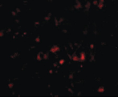 Immunofluorescence of NPTX2 in Human Brain cells with NPTX2 antibody at 20 ug/ml.