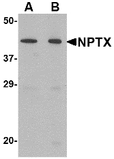 Western blot of NPTX2 in mouse brain tissue lysate with NPTX2 antibody at (A) 0.5 and (B) 1 ug/ml.