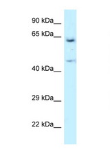 NARS antibody LS-C145562 Western blot of U937 Cell lysate. Antibody concentration 1 ug/ml.