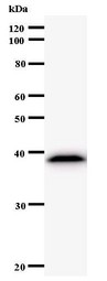 Western blot of immunized recombinant protein using NARS antibody.