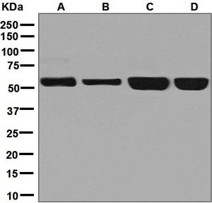 Western blot analysis on (A) fetal liver, (B) HepG2, (C) K562, and (D) HT-1080 lysates using anti-NARS antibody.