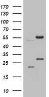 HEK293T cells were transfected with the pCMV6-ENTRY control (Left lane) or pCMV6-ENTRY NARS2 (Right lane) cDNA for 48 hrs and lysed. Equivalent amounts of cell lysates (5 ug per lane) were separated by SDS-PAGE and immunoblotted with anti-NARS2.
