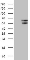 HEK293T cells were transfected with the pCMV6-ENTRY control (Left lane) or pCMV6-ENTRY NARS2 (Right lane) cDNA for 48 hrs and lysed. Equivalent amounts of cell lysates (5 ug per lane) were separated by SDS-PAGE and immunoblotted with anti-NARS2.
