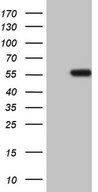 HEK293T cells were transfected with the pCMV6-ENTRY control (Left lane) or pCMV6-ENTRY NARS2 (Right lane) cDNA for 48 hrs and lysed. Equivalent amounts of cell lysates (5 ug per lane) were separated by SDS-PAGE and immunoblotted with anti-NARS2.