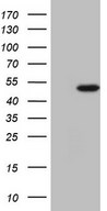 HEK293T cells were transfected with the pCMV6-ENTRY control (Left lane) or pCMV6-ENTRY NARS2 (Right lane) cDNA for 48 hrs and lysed. Equivalent amounts of cell lysates (5 ug per lane) were separated by SDS-PAGE and immunoblotted with anti-NARS2.