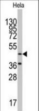 Western blot of anti-NARS2 Antibody in HeLa cell line lysates (35 ug/lane). NARS2(arrow) was detected using the purified antibody.