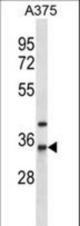 NAT1 Antibody western blot of A375 cell line lysates (35 ug/lane). The NAT1 antibody detected the NAT1 protein (arrow).