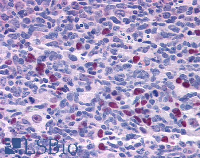 Anti-NAT10 antibody IHC of human tonsil. Immunohistochemistry of formalin-fixed, paraffin-embedded tissue after heat-induced antigen retrieval. Antibody LS-B4935 concentration 3.75 ug/ml.