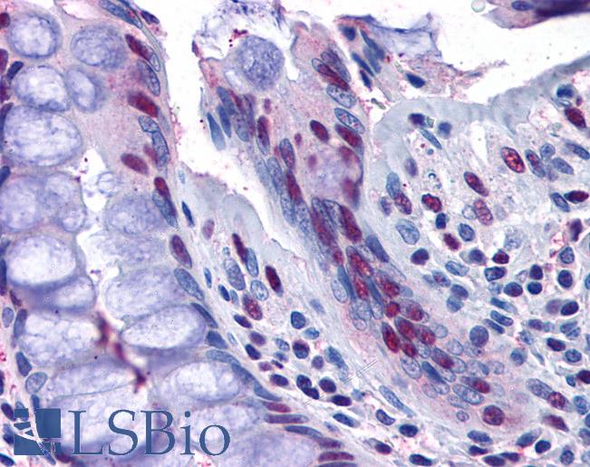 Anti-NAT10 antibody IHC of human colon. Immunohistochemistry of formalin-fixed, paraffin-embedded tissue after heat-induced antigen retrieval. Antibody LS-B4935 concentration 3.75 ug/ml.