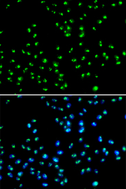 Immunofluorescence blot of MCF7 cell using NAT10 antibody. Blue: DAPI for nuclear staining.