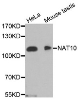 Western blot analysis of extracts of various cell lines, using NAT10 antibody.