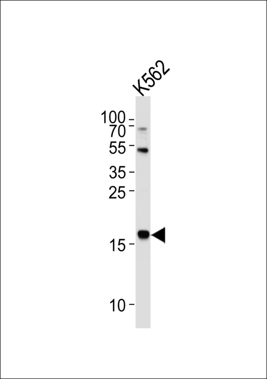 Western blot of lysate from K562 cell line, using NAT14 Antibody. Antibody was diluted at 1:1000 at each lane. A goat anti-rabbit IgG H&L (HRP) at 1:5000 dilution was used as the secondary antibody. Lysate at 35ug per lane.
