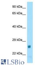NAT15 antibody Western Blot of Rat Heart. Antibody dilution: 1 ug/ml.