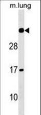 NAT15 Antibody western blot of mouse lung tissue lysates (35 ug/lane). The NAT15 Antibody detected the NAT15 protein (arrow).