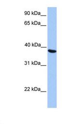 HepG2 cell lysate. Antibody concentration: 1.0 ug/ml. Gel concentration: 12%.