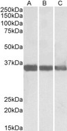 MDH1 antibody (0.01 ug/ml) staining of Human (A), Mouse (B) and Rat (C) Heart lysate (35 ug protein in RIPA buffer). Primary incubation was 1 hour. Detected by chemiluminescence.