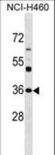NAT6 Antibody western blot of NCI-H460 cell line lysates (35 ug/lane). The NAT6 antibody detected the NAT6 protein (arrow).