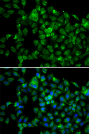Immunofluorescence blot of A549 cell using NAT8B antibody. Blue: DAPI for nuclear staining.