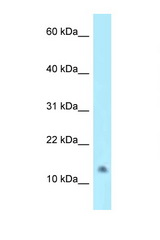 NAT8L antibody LS-C146034 Western blot of HepG2 Cell lysate. Antibody concentration 1 ug/ml.