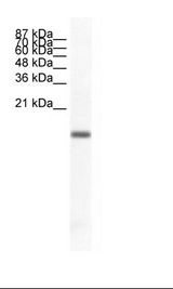 Jurkat Cell Lysate