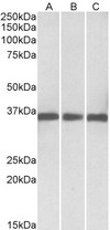 MDH1 antibody (0.03 ug/ml) staining of Human (A), Mouse(B) and Rat (C) lysates (35 ug protein in RIPA buffer). Primary incubation was 1 hour. Detected by chemiluminescence.