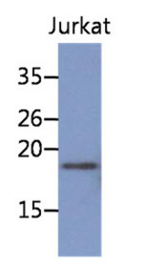 Western Blot: The cell lysate of Jurkat (30 ug) were resolved by SDS-PAGE, transferred to PVDF membrane and probed with anti-human NBL1 antibody (1:1000). Proteins were visualized using a goat anti-mouse secondary antibody conjugated to HRP and an ECL detection system.