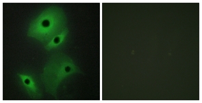 Immunofluorescence of HeLa cells, using NBL1 Antibody. The picture on the right is treated with the synthesized peptide.