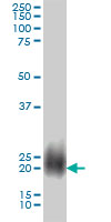 NBL1 monoclonal antibody (M01), clone 2G4 Western Blot analysis of NBL1 expression in A-431.
