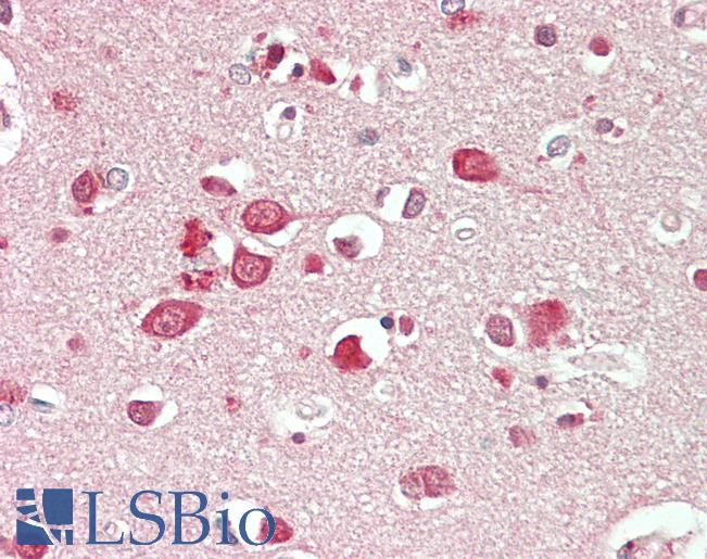 Anti-NBEA / Neurobeachin antibody IHC staining of human brain, cortex. Immunohistochemistry of formalin-fixed, paraffin-embedded tissue after heat-induced antigen retrieval. Antibody LS-B11147 concentration 10 ug/ml.