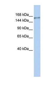 NBEAL1 antibody LS-C101895 Western blot of MCF7 cell lysate.