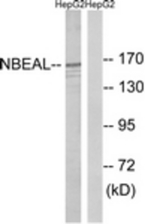 Western blot of extracts from HepG2 cells, using NBEAL1 Antibody. The lane on the right is treated with the synthesized peptide.