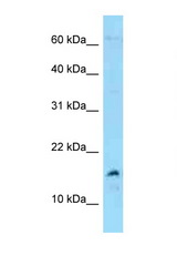 MDK / Midkine antibody LS-C146247 Western blot of 3 Cell lysate. Antibody concentration 1 ug/ml.