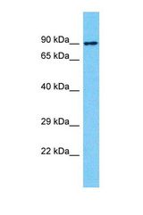 Western blot of Human HT1080. NBPF10 antibody dilution 1.0 ug/ml.
