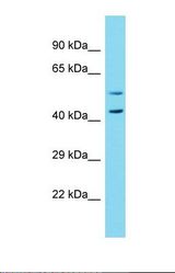Western blot of Fetal Liver. NBPF7 antibody dilution 1.0 ug/ml.