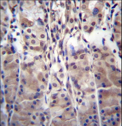 MDM1 Antibody immunohistochemistry of formalin-fixed and paraffin-embedded human stomach tissue followed by peroxidase-conjugated secondary antibody and DAB staining.