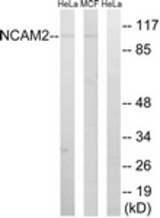 Western blot of extracts from MCF-7/HeLa cells, using NCAM2 Antibody. The lane on the right is treated with the synthesized peptide.