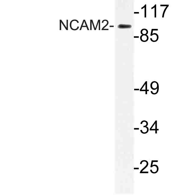 Western blot of NCAM2 (L296) pAb in extracts from HeLa cells.