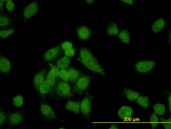 Immunofluorescence of monoclonal antibody to CNAP1 on HeLa cell. [antibody concentration 10 ug/ml]