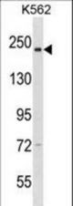 NCAPD3 Antibody western blot of K562 cell line lysates (35 ug/lane). The NCAPD3 antibody detected the NCAPD3 protein (arrow).