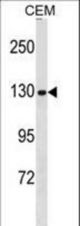 NCAPG Antibody western blot of CEM cell line lysates (35 ug/lane). The NCAPG antibody detected the NCAPG protein (arrow).