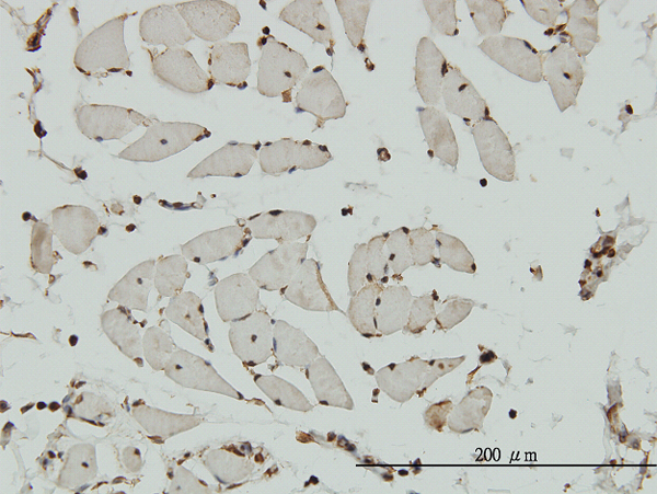 Immunoperoxidase of monoclonal antibody to HCAP-G on formalin-fixed paraffin-embedded human skeletal muscle. [antibody concentration 3 ug/ml]